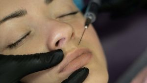 Botox e Baby botox, cosa sono